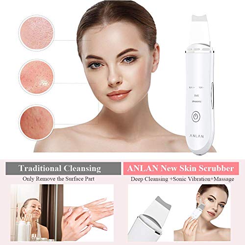 ANLAN Peeling Ultrasónico Facial Skin Scrubber Exfoliación Facial Ultrasónica Limpiador de Poros para Limpieza Facial y Cuidado Facial