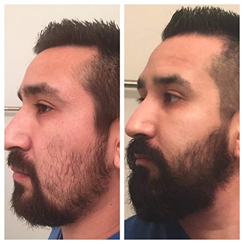 Derma Roller - Kit de crecimiento de barba para barba, rodillo de derma + aceite de suero para el crecimiento de la barba + bálsamo para barba, regalo perfecto para hombres