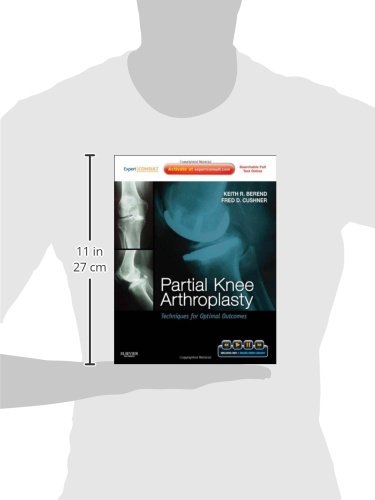 Partial Knee Arthroplasty: Techniques for Optimal Outcomes with DVD; Expert Consult - Online & Print, 1e