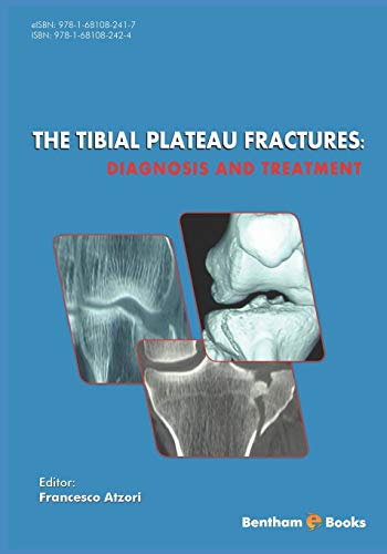 The Tibial Plateau Fractures:: Diagnosis and Treatmment