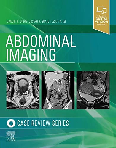 Abdominal Imaging: Case Review Series (English Edition)