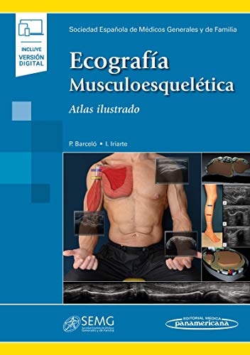 Ecografia musculoesqueletica (incluye version digital): Atlas Ilustrado ((incluye versión digital))