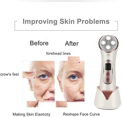 MiSMON Facial Aparato Radiofrecuencia, 5 Modos de Terapia de luz LED, Aparato Facial Ultrasonido, Limpieza Profunda, Antiarrugas, Rejuvenecimiento, Anti-envejecimiento, Anti-acné, Cuidado Facial