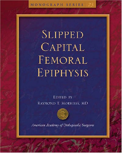 Slipped Capital Femoral Epiphysis (AAOS Monograph Series)