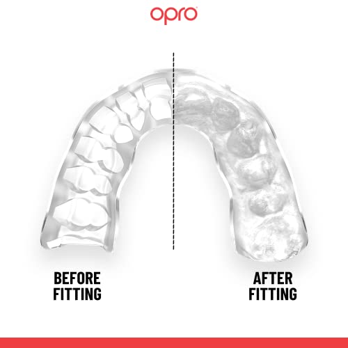Opro Protector bucal instantáneo de ajuste personalizado, protector bucal para dentistas con tecnología de ajuste revolucionaria para máxima comodidad, protector bucal para rugby, boxeo, hockey, MMA